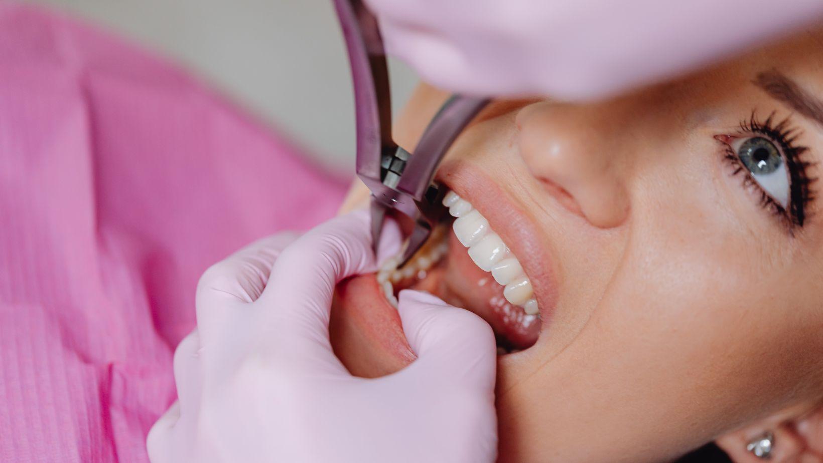 tooth extraction, immediate dental implants, same day implant procedure, implant risks, tooth extraction recovery, dental implant costs, same day implants risks, implant expectations, urgent dental implants, implant surgery precautions