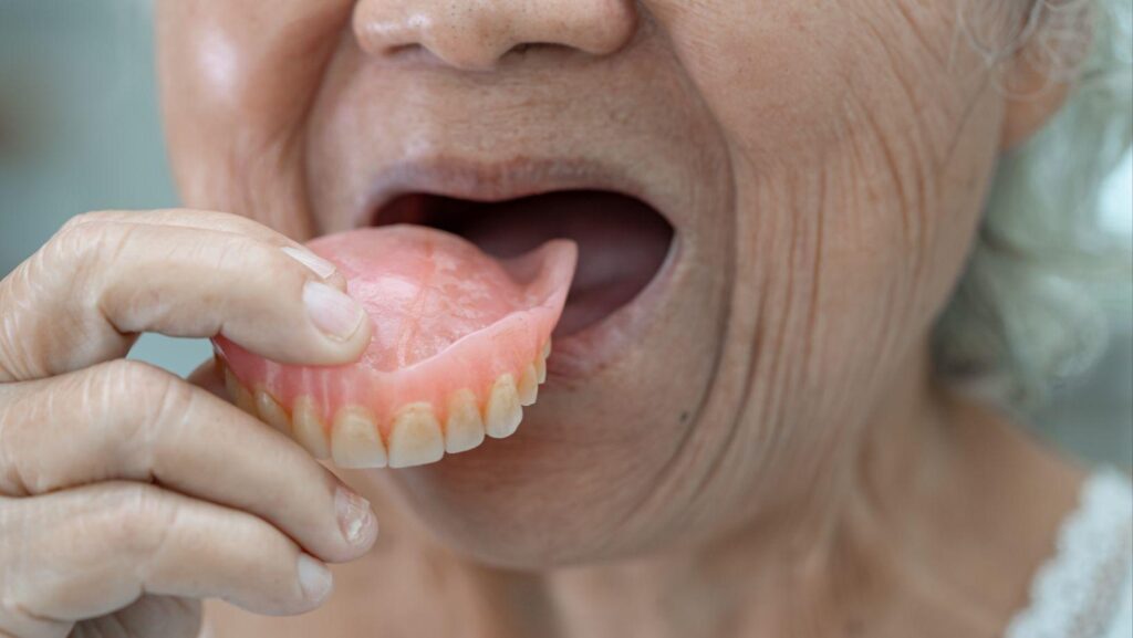 implant retained dentures, secure denture solutions, implant supported dentures, denture stability benefits, long-term denture implants, comfortable implant dentures, best implant dentures, dentures with implants, implant denture benefits
