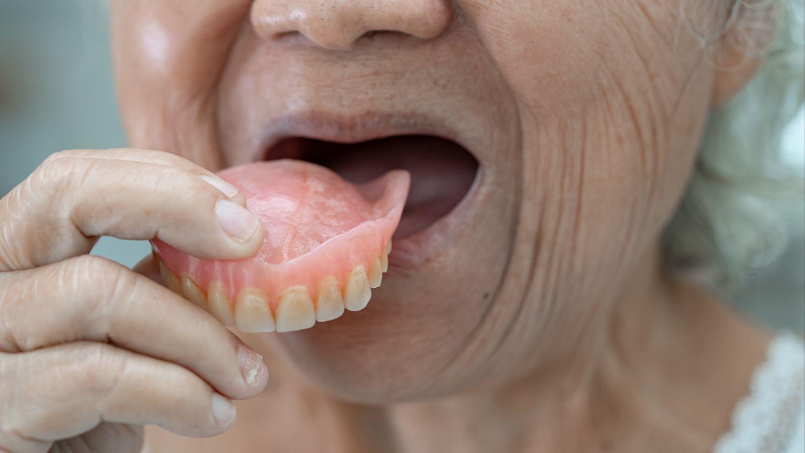 implant retained dentures, secure denture solutions, implant supported dentures, denture stability benefits, long-term denture implants, comfortable implant dentures, best implant dentures, dentures with implants, implant denture benefits